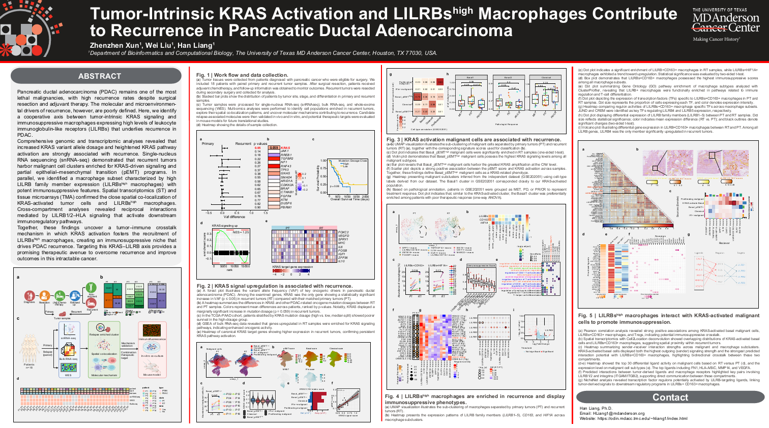 Tumor-intrinsic KRAS activation and lilrbshigh macrophages contribute to recurrence in pancreatic ductal adenocarcinoma