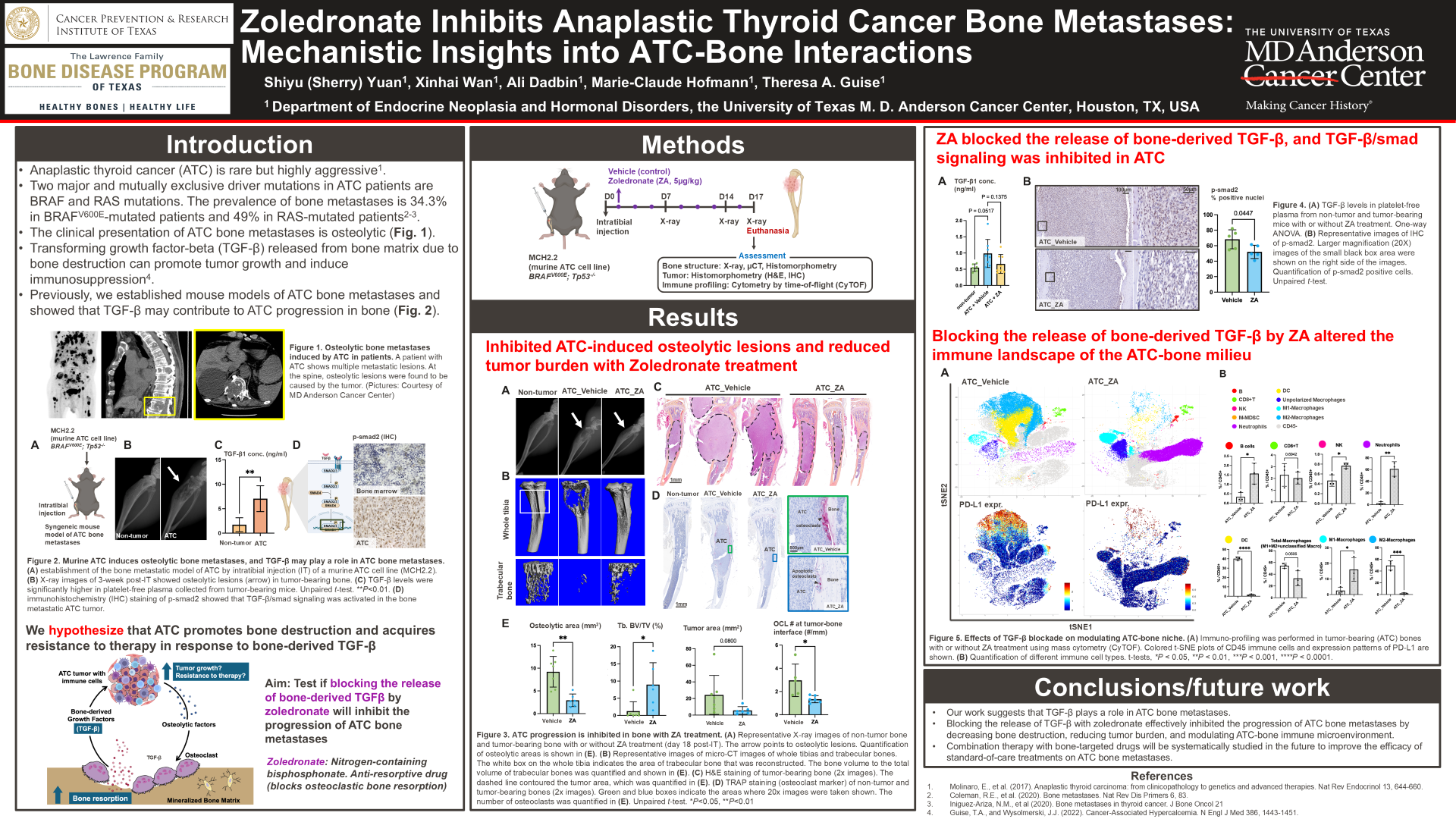 Zoledronate inhibits anaplastic thyroid cancer bone metastases: mechanistic insight into ATC-bone interactions